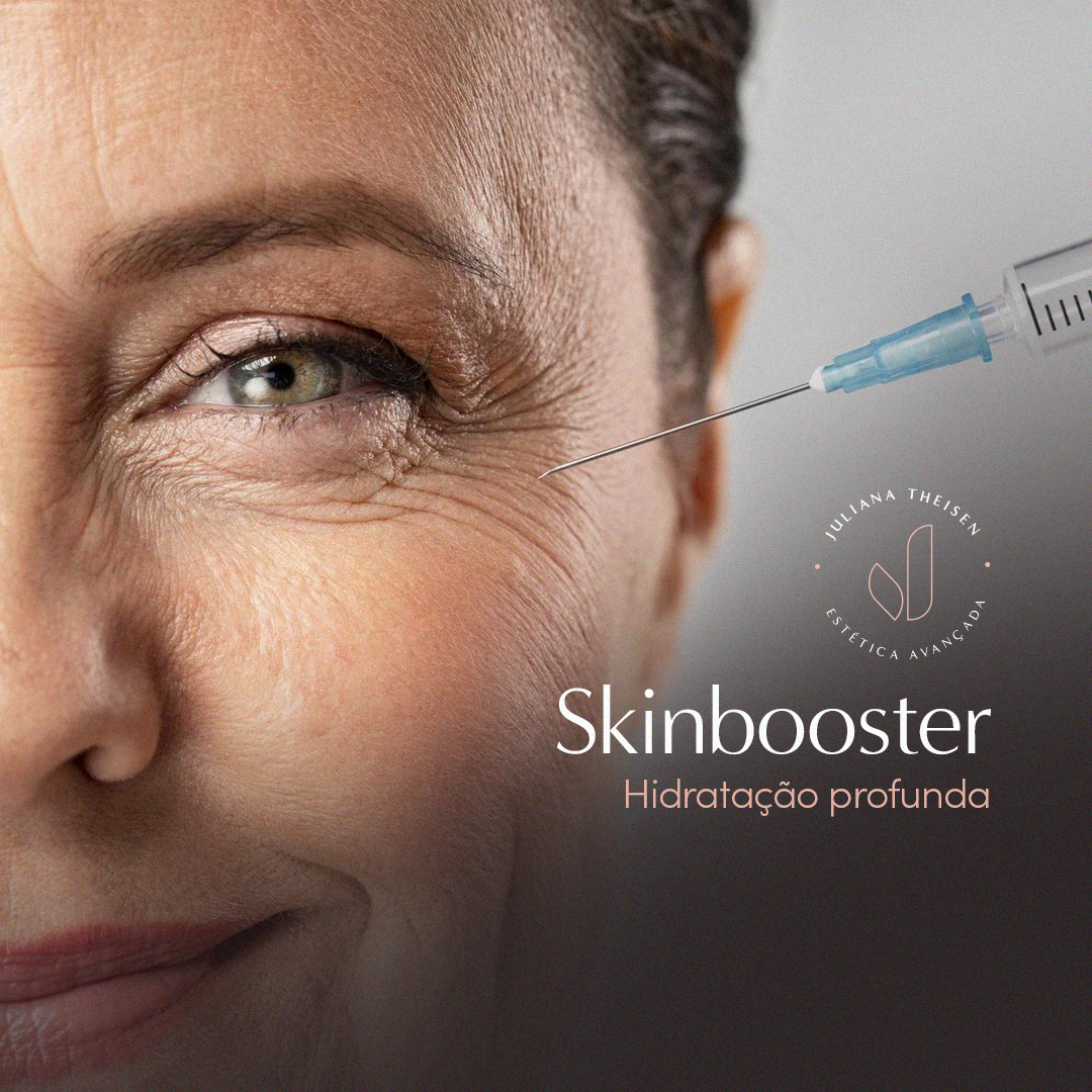 Skinbooster®